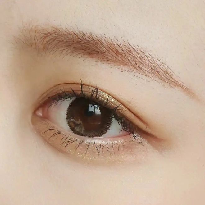 周年轮重获青春双眼不是梦j9平台杭州美莱：解密眼(图2)